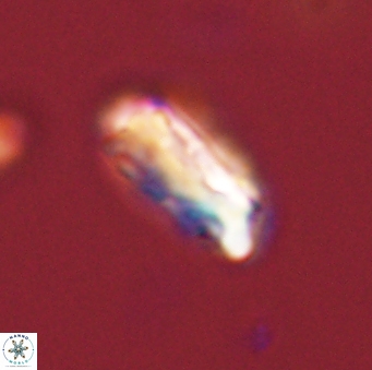 Neocrepidolithus grandiculus 43986
