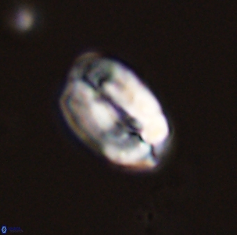 Neocrepidolithus grandiculus 43988