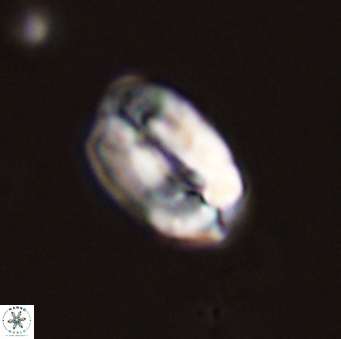 Neocrepidolithus grandiculus 43988