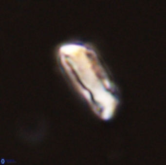 Neocrepidolithus grandiculus 43989