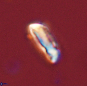 Neocrepidolithus grandiculus 43990