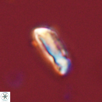Neocrepidolithus grandiculus 43990