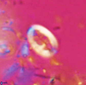 Neocrepidolithus laminatus 25421