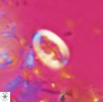 Neocrepidolithus laminatus 25421