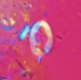Neocrepidolithus laminatus 25422