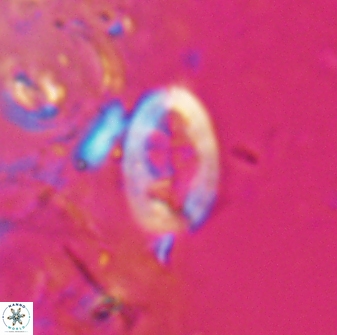 Neocrepidolithus laminatus 25422