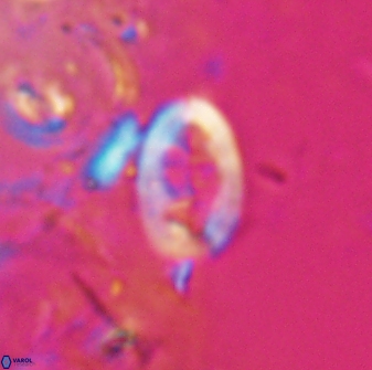 Neocrepidolithus laminatus 25423