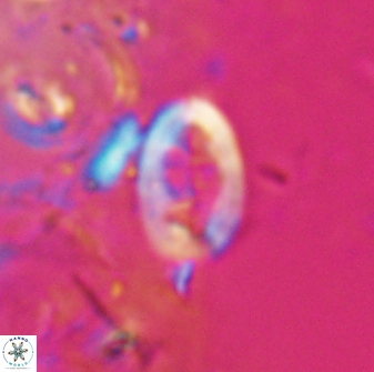 Neocrepidolithus laminatus 25423