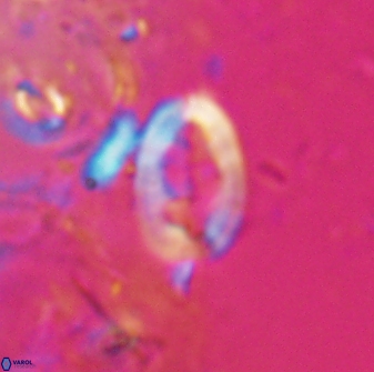 Neocrepidolithus laminatus 25424