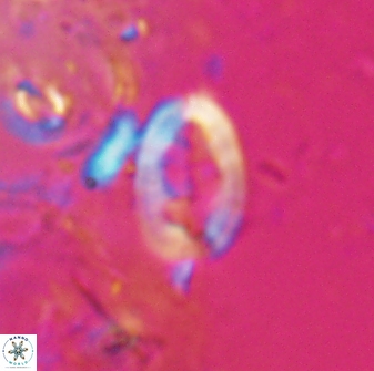 Neocrepidolithus laminatus 25424