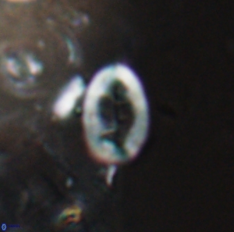 Neocrepidolithus laminatus 25425
