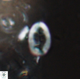 Neocrepidolithus laminatus 25425