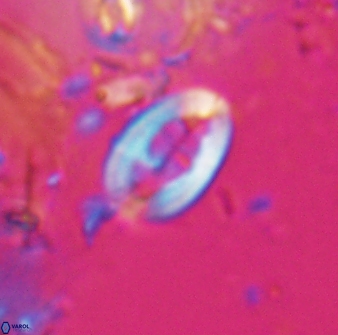 Neocrepidolithus laminatus 25427