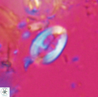 Neocrepidolithus laminatus 25427