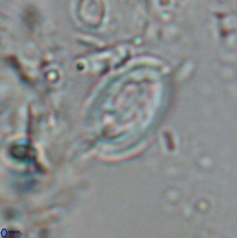 Neocrepidolithus laminatus 25428