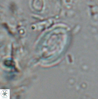 Neocrepidolithus laminatus 25428
