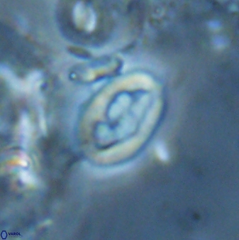 Neocrepidolithus laminatus 25429