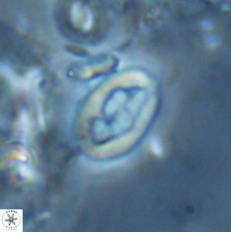 Neocrepidolithus laminatus 25429