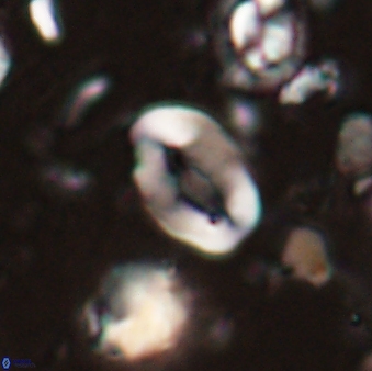 Neocrepidolithus sp 54138