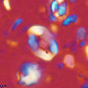 Neocrepidolithus sp 54139