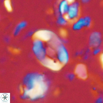 Neocrepidolithus sp 54139
