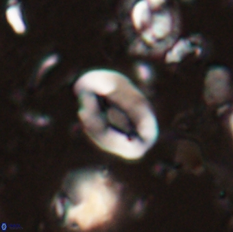 Neocrepidolithus sp 54144
