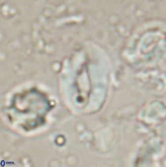 Neocrepidolithus sp 54146