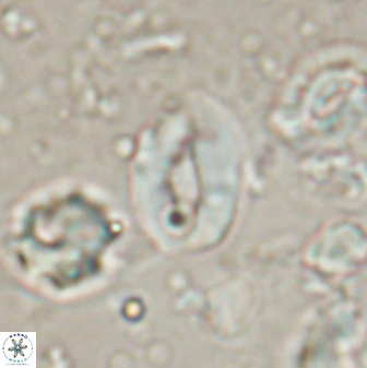 Neocrepidolithus sp 54146