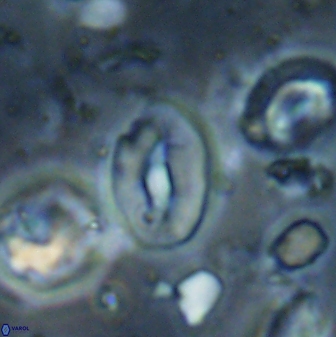 Neocrepidolithus sp 54147