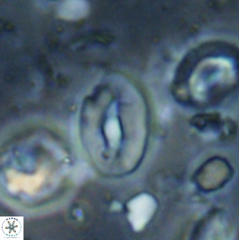 Neocrepidolithus sp 54147