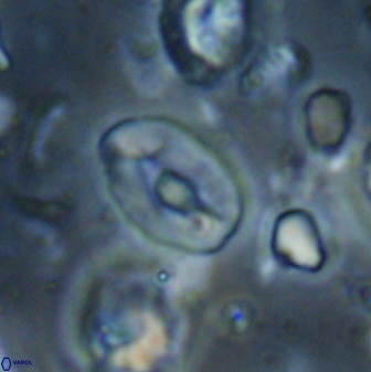 Neocrepidolithus sp 54148