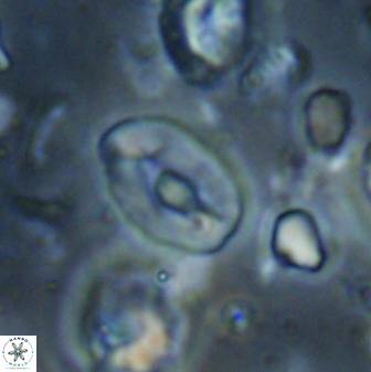 Neocrepidolithus sp 54148