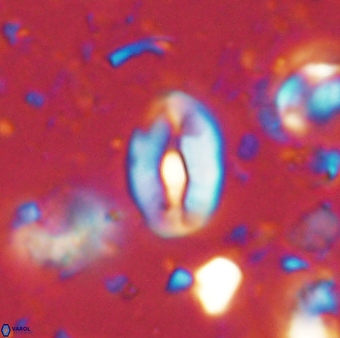 Neocrepidolithus sp 54140