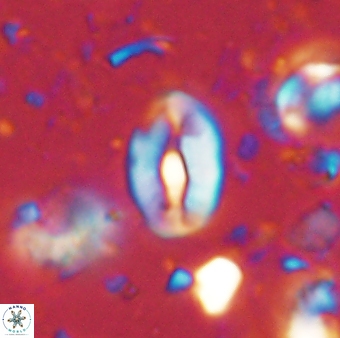 Neocrepidolithus sp 54140