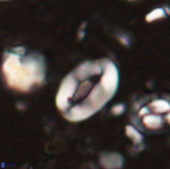 Neocrepidolithus sp 54142