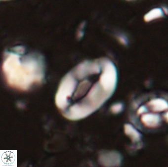 Neocrepidolithus sp 54142