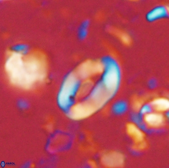 Neocrepidolithus sp 54143