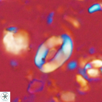 Neocrepidolithus sp 54143