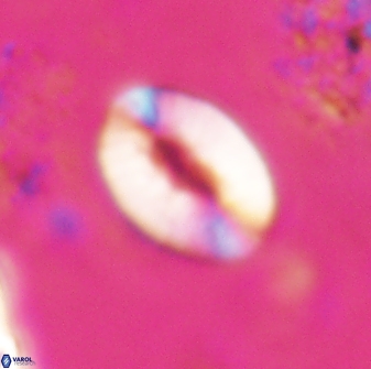 Neocrepidolithus triforaminatus 25614
