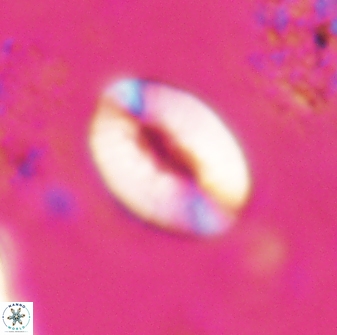 Neocrepidolithus triforaminatus 25614