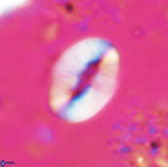 Neocrepidolithus triforaminatus 25615