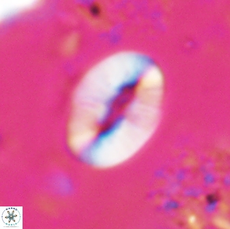 Neocrepidolithus triforaminatus 25615