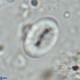 Neocrepidolithus triforaminatus 25617