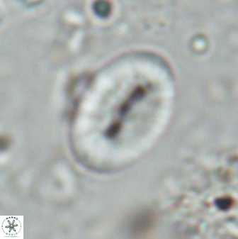 Neocrepidolithus triforaminatus 25617