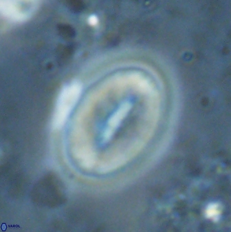 Neocrepidolithus triforaminatus 25618