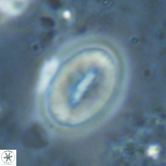 Neocrepidolithus triforaminatus 25618