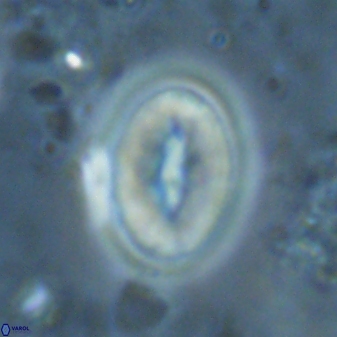 Neocrepidolithus triforaminatus 25619