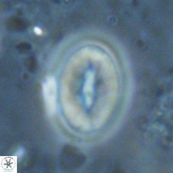 Neocrepidolithus triforaminatus 25619