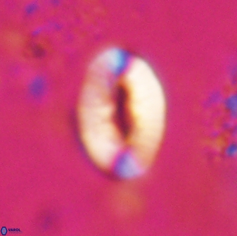 Neocrepidolithus triforaminatus 25611