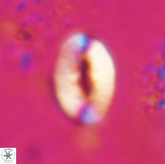 Neocrepidolithus triforaminatus 25611